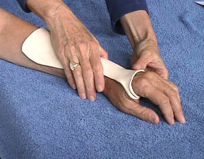 Beginner Hand Orthotic Fabrication