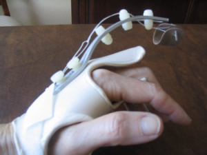 Advanced Hand Orthotic Fabrication Upper Extremity Ue Seminars